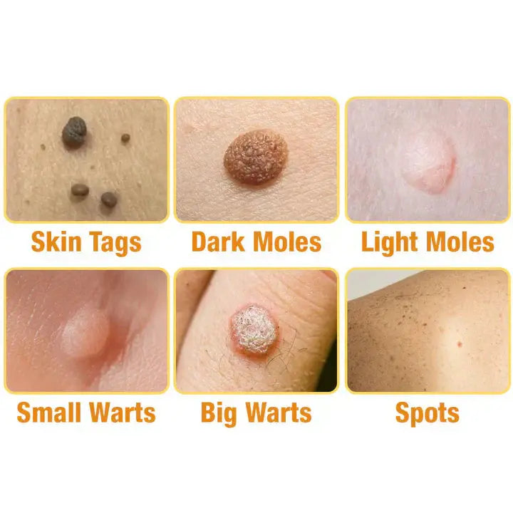 AQA™ TagRecede Bee Venom Treatment Spray AVOXZY