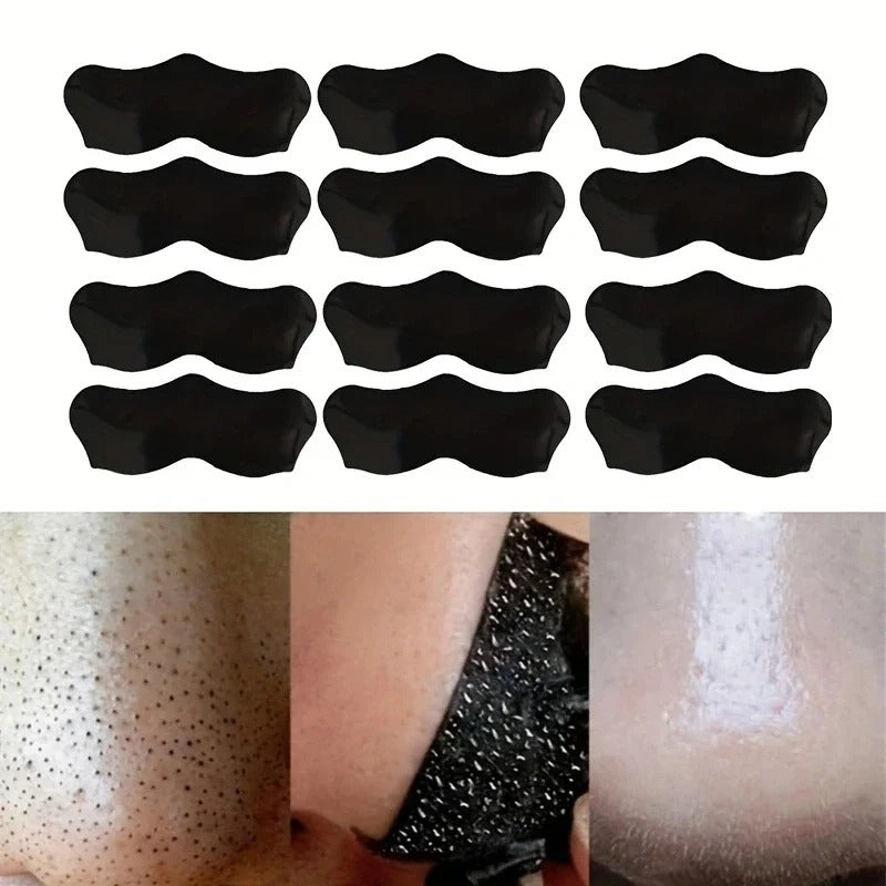 Deep Cleansing Pore Strips for Acne & Black Dots Treatment
