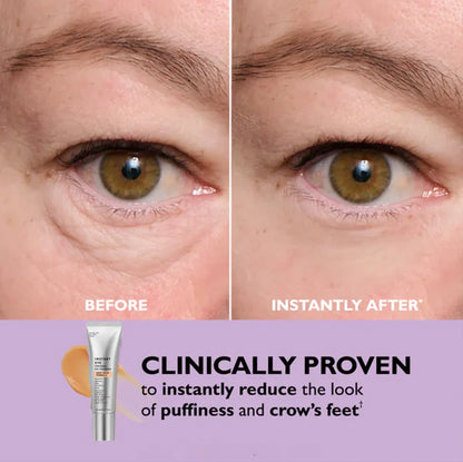 Eye Tightener™