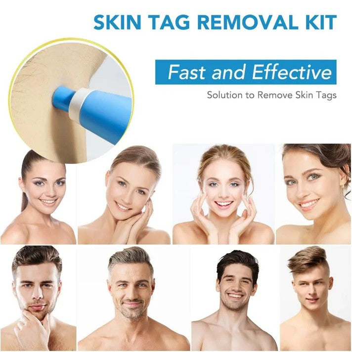 Painless Auto Skin Tag Remover