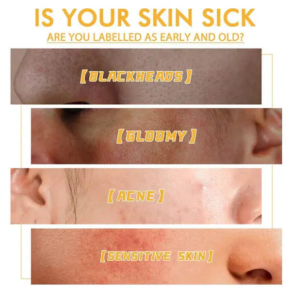 HONEY TEARING MASK AVOXZY