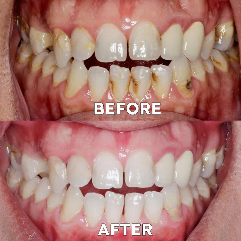 Avoxzy™ Tooth Powder