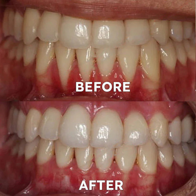 Avoxzy™ Tooth Powder