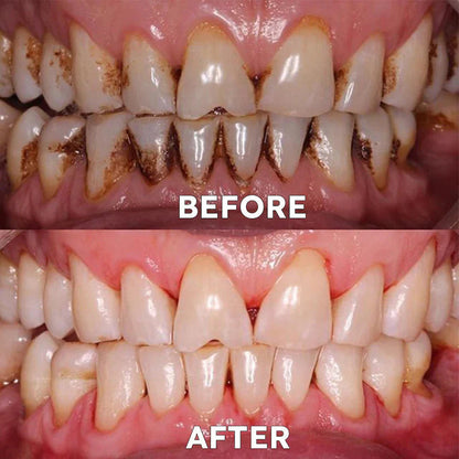 Avoxzy™ Tooth Powder
