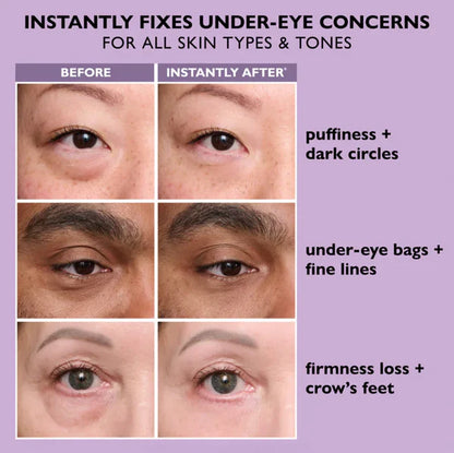 Eye Tightener™