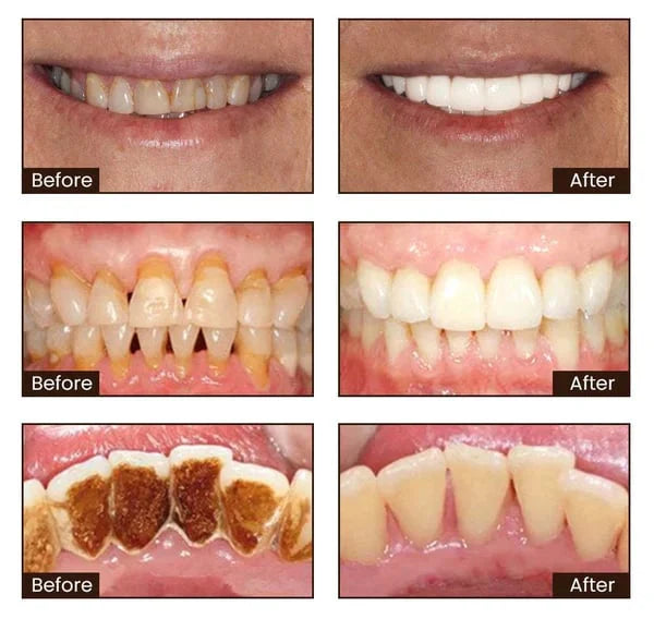 Niacinamide Whitening Toothpaste🦷