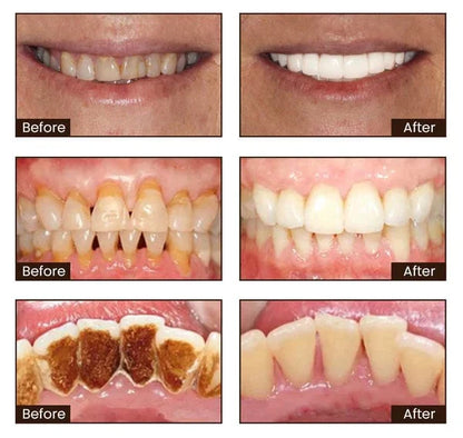 Niacinamide Whitening Toothpaste🦷