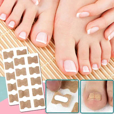 Correction Patches for Toenails - Ingrown Nail Treatment - AVOXZY