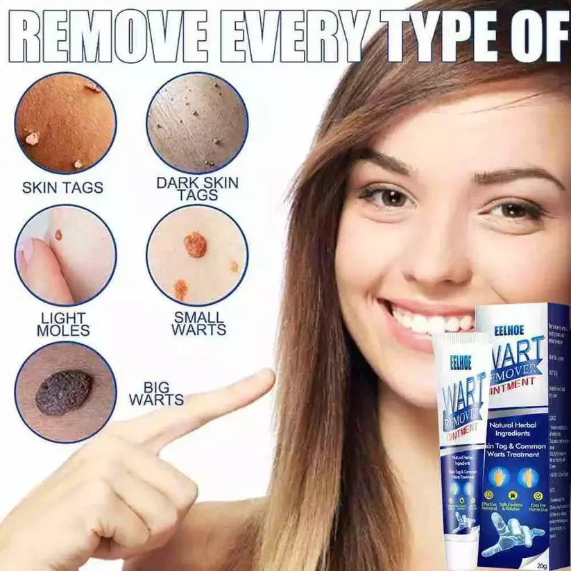 WartAway Herbal Removal Cream AVOXZY