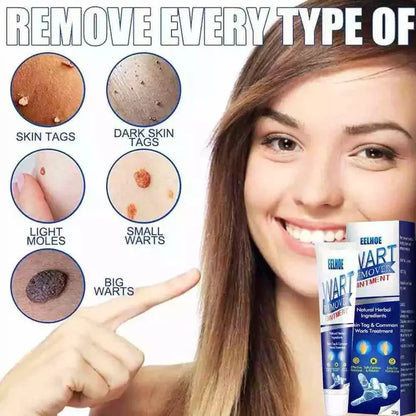WartAway Herbal Removal Cream AVOXZY