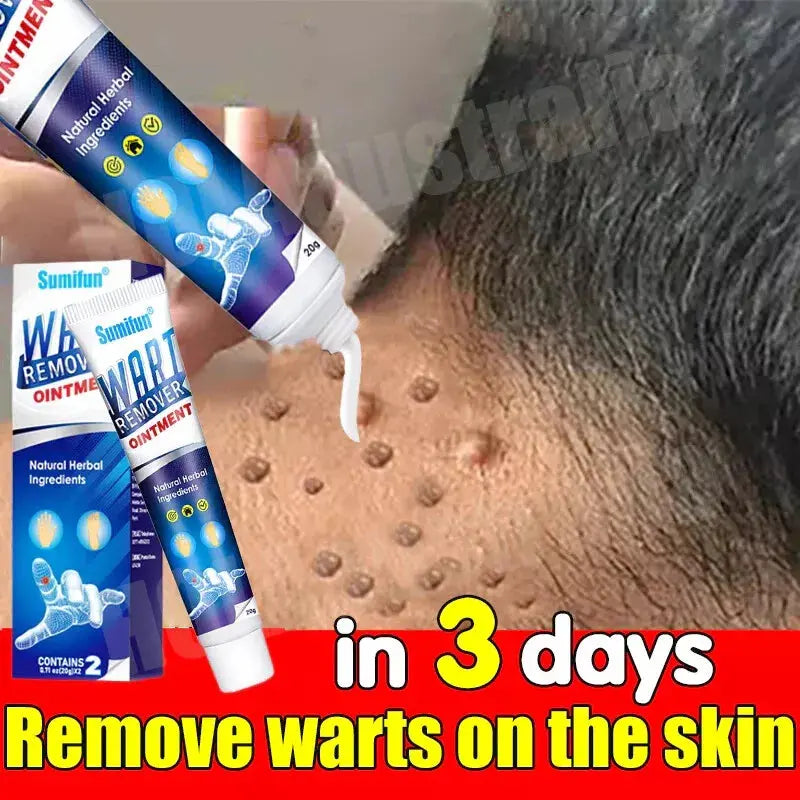 WartAway Herbal Removal Cream AVOXZY