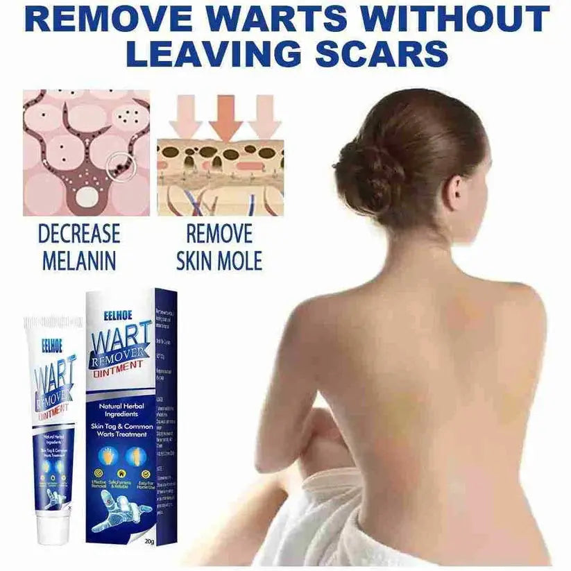 WartAway Herbal Removal Cream AVOXZY