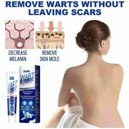 WartAway Herbal Removal Cream AVOXZY
