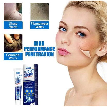 WartAway Herbal Removal Cream AVOXZY